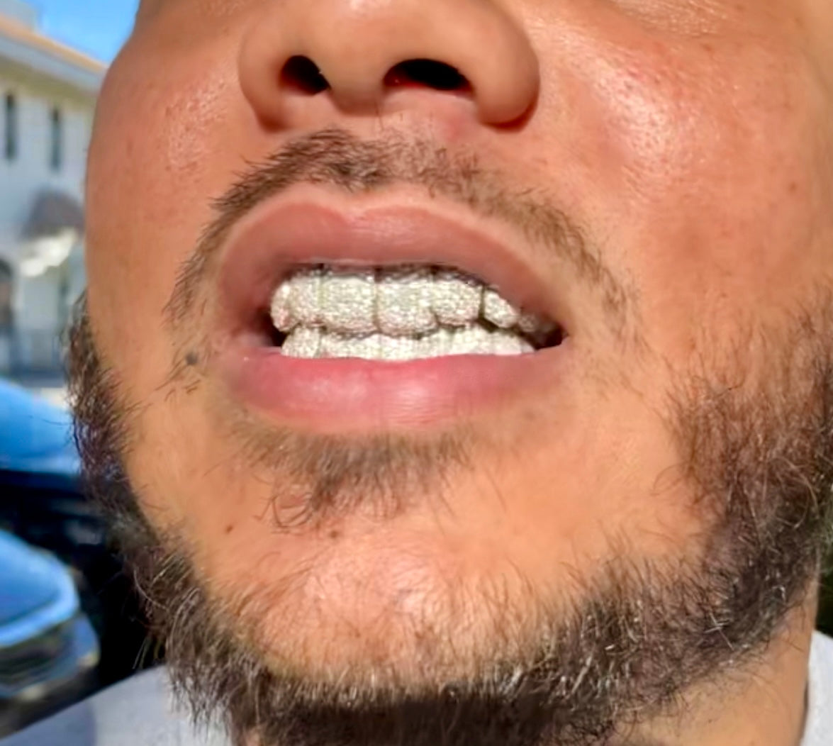 GRILLZ